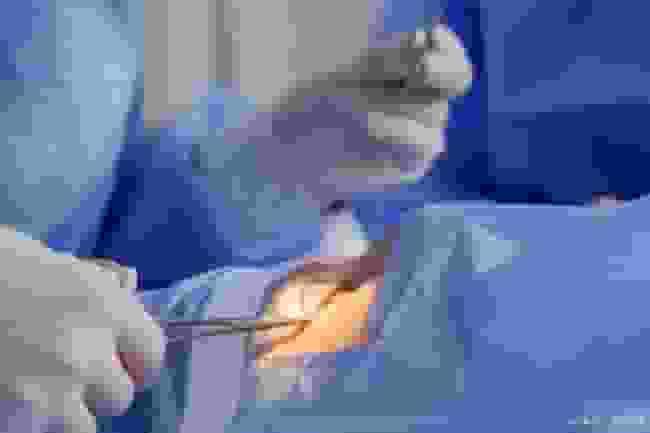 直播婦科手術洩私隱 女病人私隱部位無遮蔽畫面 5 萬人同時網上觀看