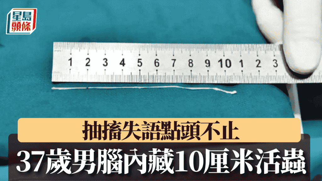 湖南37歲漢突抽搐失語狂點頭 開腦傾偈助醫生活捉10厘米活蟲