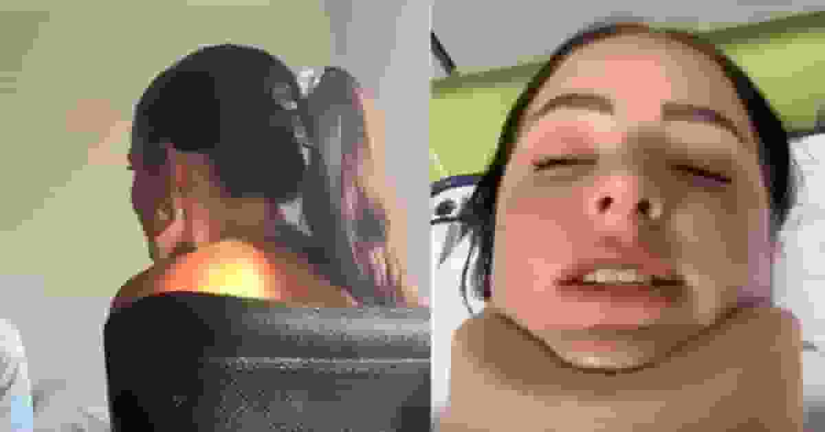 駕車遭追尾 澳洲女頭戴一物重擊腦部腦震盪扭頸 事後發文警示