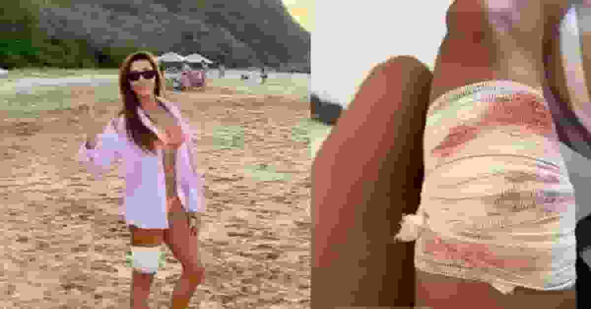 巴西女律師浮潛突遭鉸口鯊狠咬大腿不放 獲導遊出手相救死裡逃生