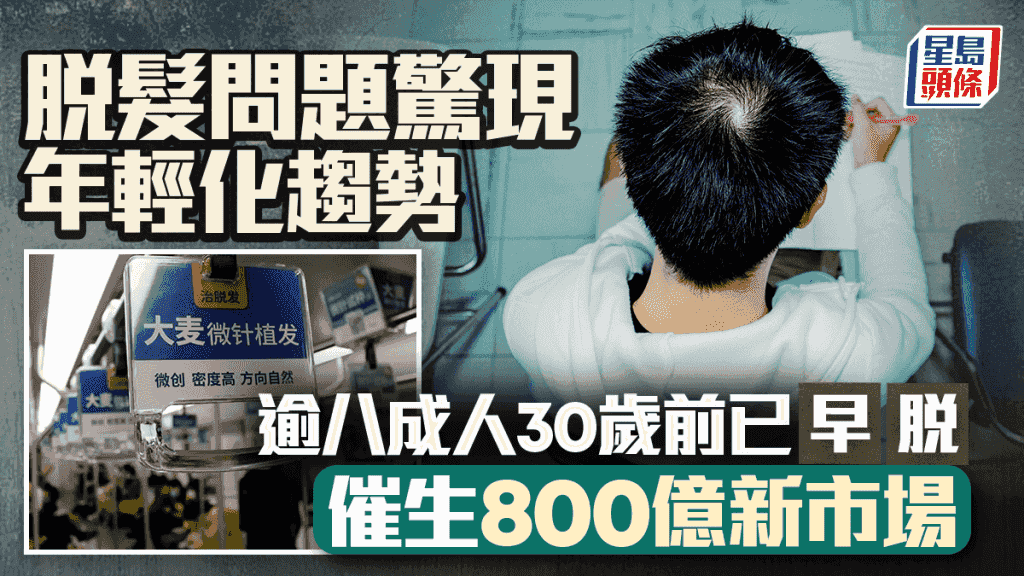 脫髮問題驚現年輕化趨勢 內地逾八成人30歲前已「早脫」 催生800億新市場